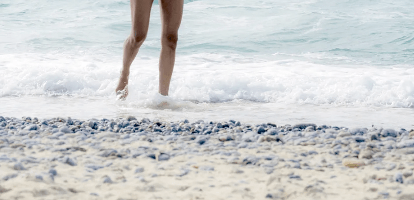 Varicose veins