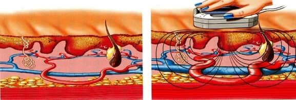 Kung ang iyong mga binti ay manhid