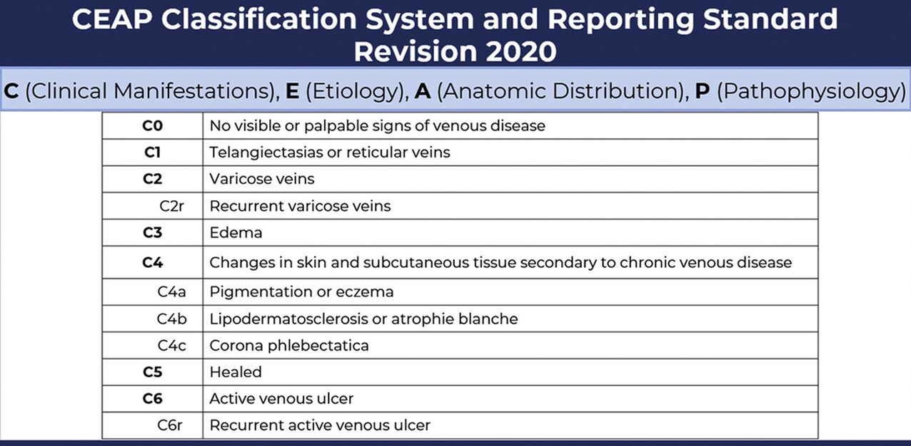 Mga yugto ng varicose veins ayon sa pag-uuri ng CEAP na may mga pag-amyenda mula 2020